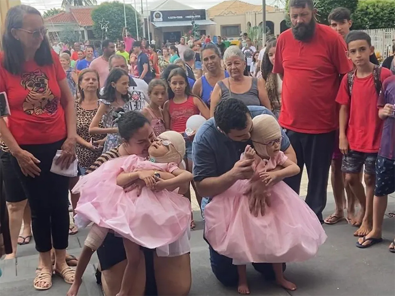 Piquerobi faz festa para receber irmãs siamesas, Allana e Mariah, após separação craniana