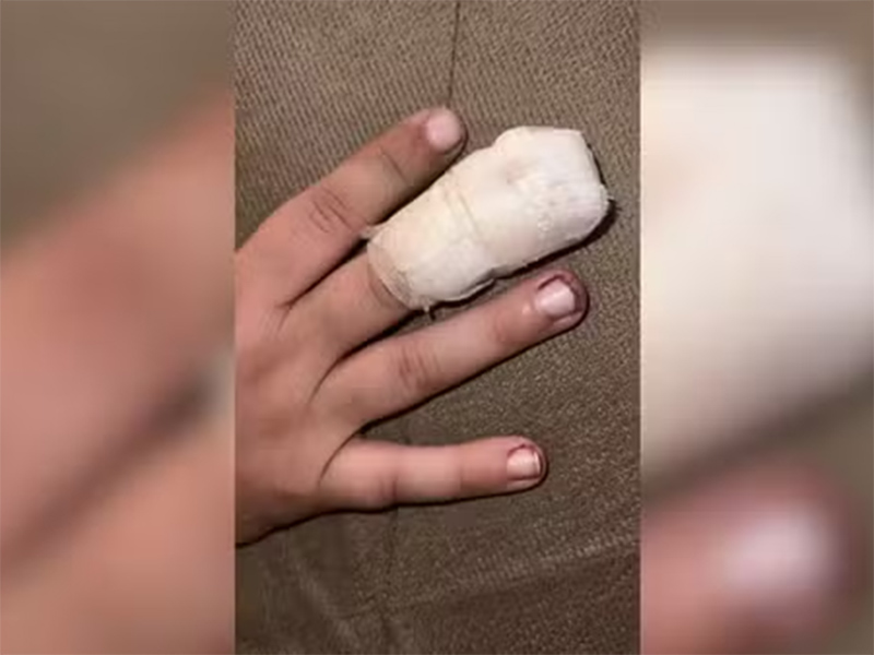 Mãe alega que menino teve dedo esmagado por colegas dentro de escola pública no interior de SP