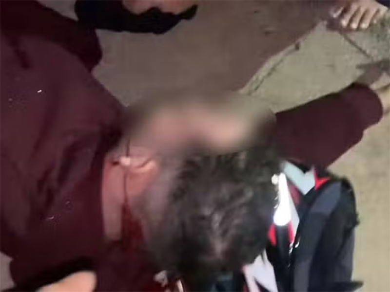 Policial militar acerta tiro na nuca de motociclista que tentou escapar de abordagem em Prudente