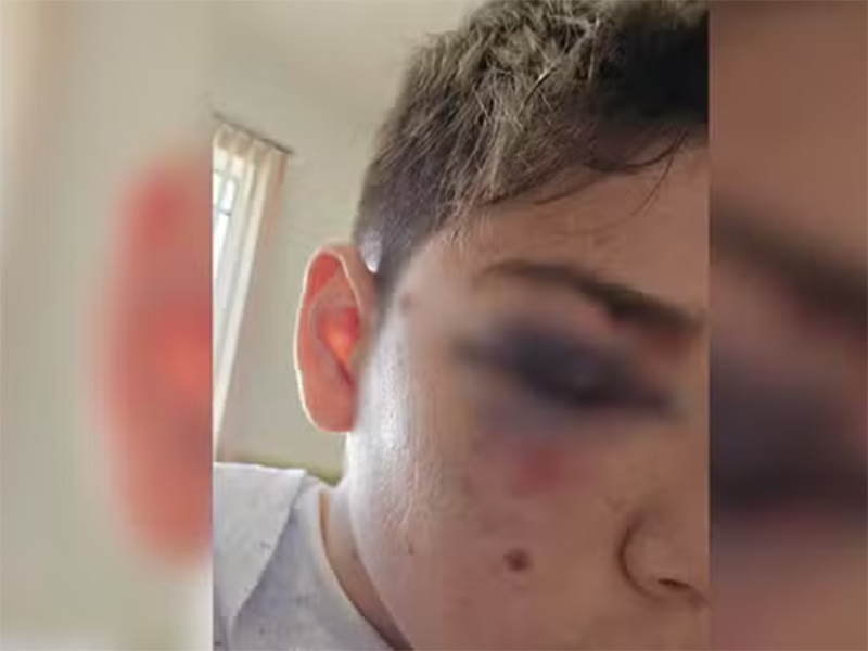 Estudante é agredido por colega de sala dentro de escola no interior de SP